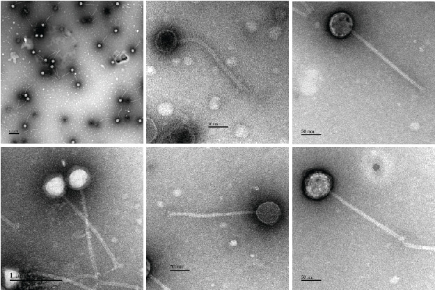 A search for anti-CRISPRs